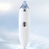 Portable Blackhead Vacuum Remover Trenzora